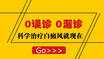 治疗白癜风为什么不能急于求成